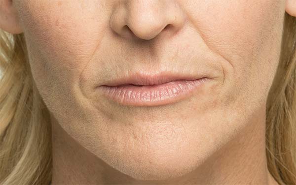 Close-up of female patient's face before treatment